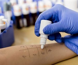 Key paper on proteomics in the field of allergy published in the World Allergy Journal