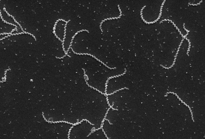 A microscopy image of Leptospira bacteria [Credit: Wunder et al. (CC BY 4.0)].