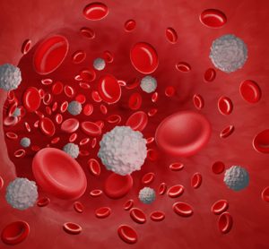 Leukaemia