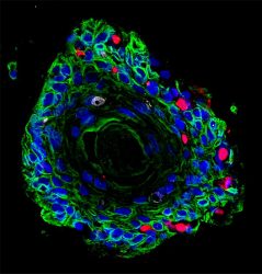 Image showing Ectocervical Organoid