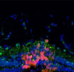 Cell therapy to restore photoreceptors in the retina (IMAGE)