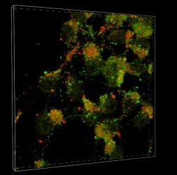 Image showing how how Parkinson’s disease and Lewy body dementia spreads in the brain