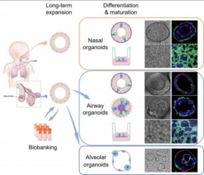 organoids 