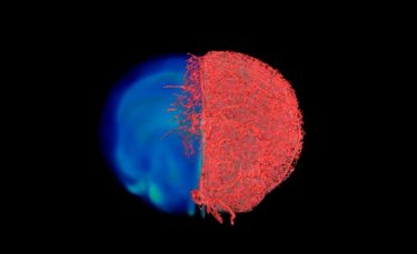 A still from the visual demonstration of the result of the VascuViz imaging pipeline.