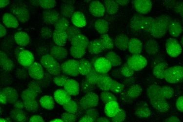 Image showing an image developed by the researchers.  mRNA labeled with green fluorescent proteins on black background