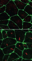 Stem cells with and without cilia (IMAGE). Cilia labeled in red, cell junctions in green.