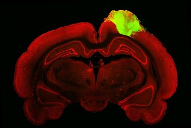 histological image of a rat brain with a grafted human brain organoid (IMAGE)