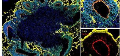 Brain organoids in detail: structural details of organoids (yellow and red) and organoid cells (blue and green)