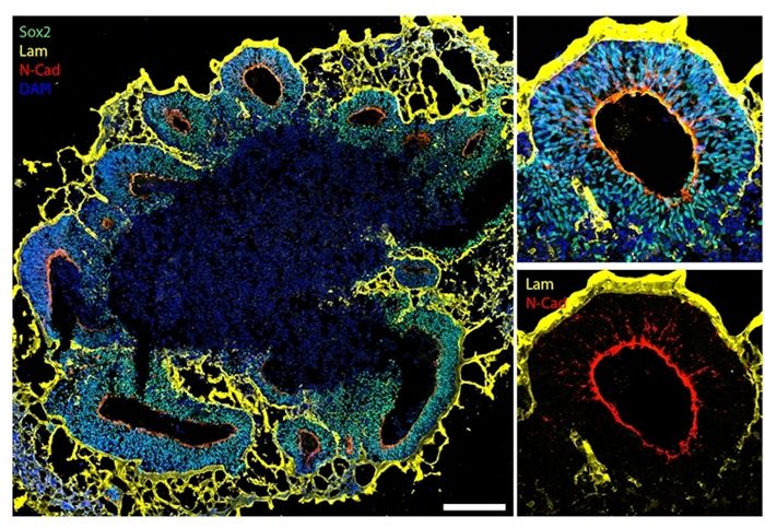 Brain organoids in detail: structural details of organoids (yellow and red) and organoid cells (blue and green)