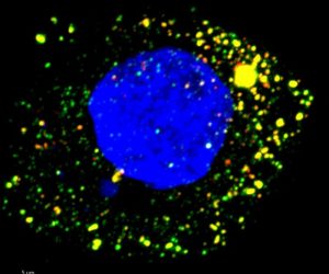 Imaging showing Fluorescence microscopy image of HAV-infected cultured human liver cell. viral RNA targeted by ZCCHC14 appears green, and the virus’s protein red