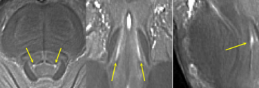 Locus coeruleus in 7T scan (IMAGE)