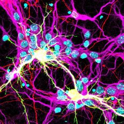 fused neurons 