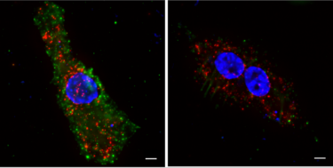 Image showing two photos of human dendritic cells. HIV-1 particles (depicted in red) ; cGAMP (depicted in green) and Nuclei (Dapi) are depicted in blue