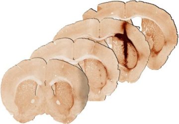 Mouse brain tissue 28 days after injection of hydrogel with myoglobin (IMAGE)