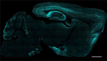 Cre from AAV (IMAGE): protein Cre (green) delivered to cells as gene therapy via AAV.