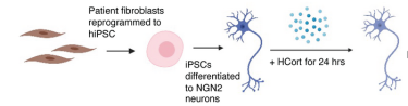 Graphic representation: skin cells being reprogrammed into induced pluripotent stem cells, then into neurons that were exposed to stress hormone and subsequently observed by the study team.