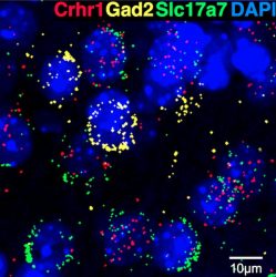 Image: Scripps Research scientists find the immune protein CSF1 may contribute to anxiety during alcohol withdrawal. Some nuclei (blue) have the corticotropin-releasing factor receptor 1 crhr1 gene (red), as well as the glutamate transporter gene slc17a7 (green), but not the glutamate decarboxylase gene gad2 (yellow), suggesting that they predominantly comprise an excitatory population in the medial prefrontal cortex. Alcohol withdrawal results in increased CSF1 in these neurons, mimicking synaptic changes in glutamate transmission seen following alcohol withdrawal, and leading to heightened anxiety.