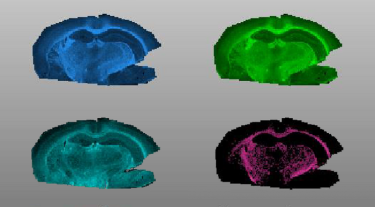 Image: The newly identified class of lipids, called SGDGs, decrease with aging, which suggests they may play a role in brain ageing.