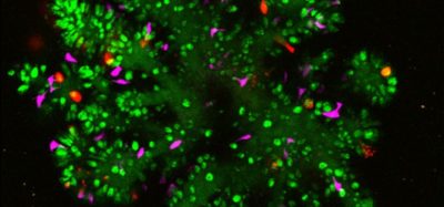 Improved small intestinal organoid with Paneth cells in red (IMAGE)