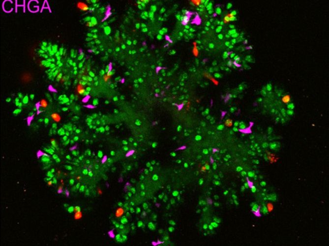 Improved small intestinal organoid with Paneth cells in red (IMAGE)