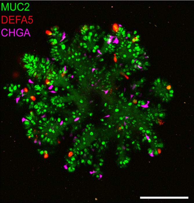 Improved small intestinal organoid with Paneth cells in red (IMAGE)