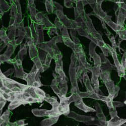 Image showing Hepatic stellate cells along with their intricate cellular projections (green) are shown wrapped around blood vessels (grey) in the healthy liver.