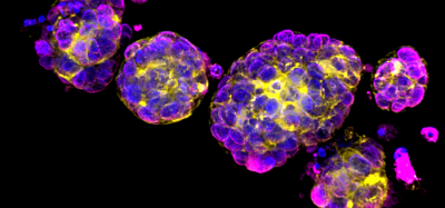 Image showing breast cancer organoid cells