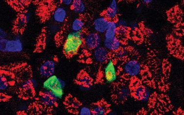 Image showing COVID-19 infected cells.