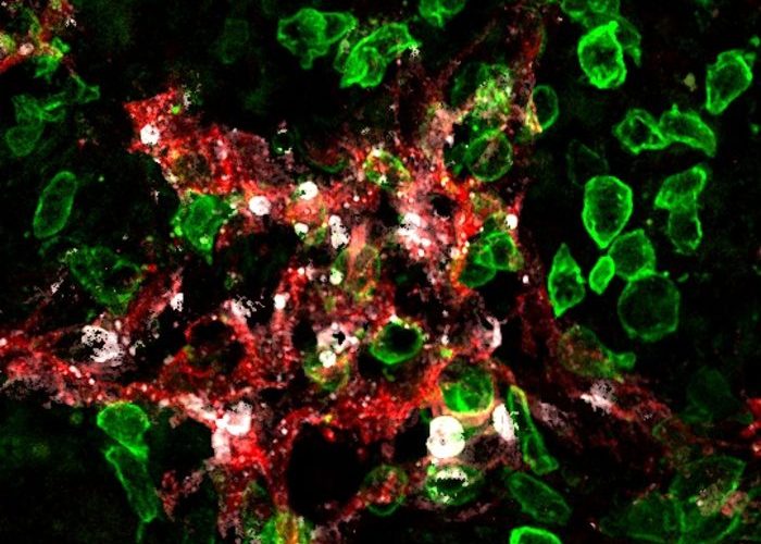 Image: Killer-T cells (green) attack lymphatic vessels (red) in tumours and induce their death (cell death marker in white).