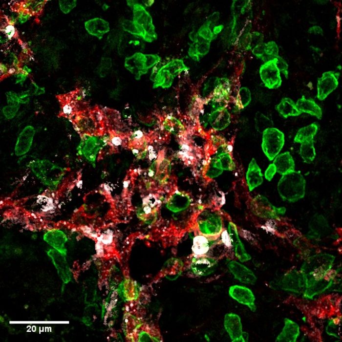 Image: Killer-T cells (green) attack lymphatic vessels (red) in tumours and induce their death (cell death marker in white).