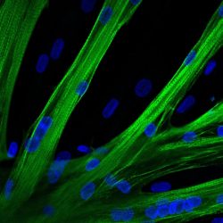 Gene editing in human muscle stem cells. A myosin heavy chain is seen in green and the nuclei in blue.