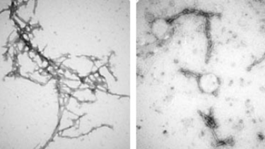 Image showing the structure of alpha-synuclein clumps (on the left) was disrupted by the nanobody PFFNB2 (as shown on the right).