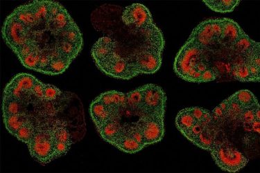 Slices of mini–brain organoids with neural stem cells (red) and cortical neurons (green). (IMAGE)