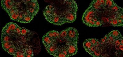 Slices of mini–brain organoids with neural stem cells (red) and cortical neurons (green). (IMAGE)