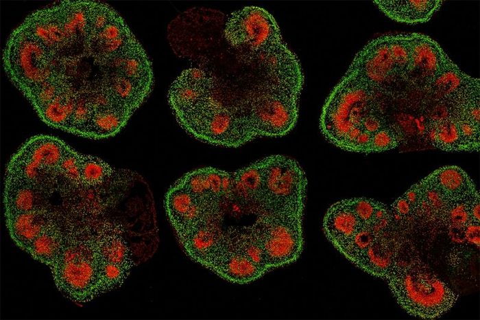 Slices of mini–brain organoids with neural stem cells (red) and cortical neurons (green). (IMAGE)