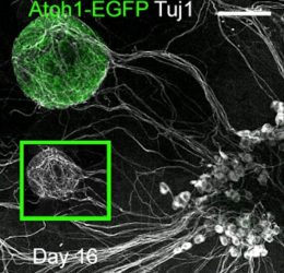 Stem cell researchers generated “cochlear organoids with functional synapses for the first time, which provides a platform for deciphering the mechanisms of sensorineural hearing loss,” opening up avenues for investigating new therapeutic approaches.