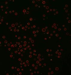 Yeast under a microscope: Yeast with a red fluorescent protein marking the vacuole - the nutrient storage compartment of the cell - and a green fluorescent protein marking aggregates of TORC1 that form in cells missing Ait1.