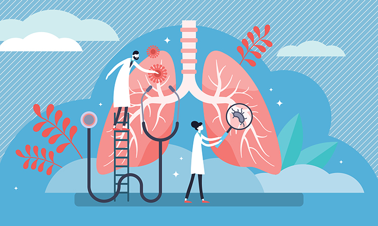 Single-cell atlas of lung cancer