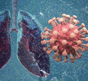 COVID-19 and inflammation