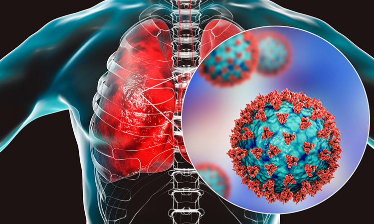 SARS-CoV-2 in lungs