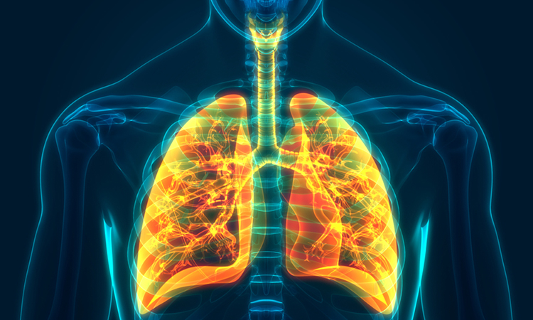 pulmonary artery hypertension