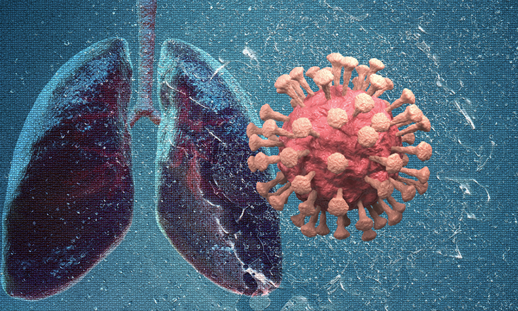 COVID-19 and inflammation