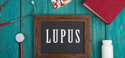 lupus