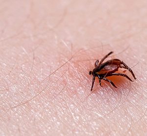Lyme disease
