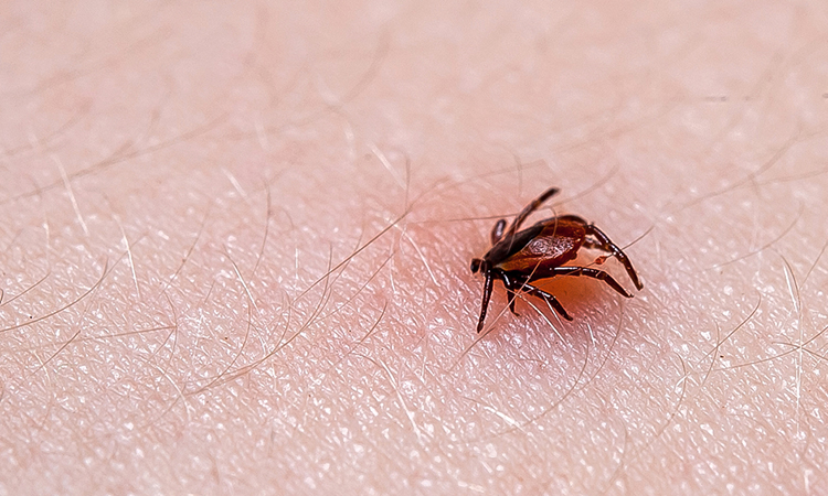 Lyme disease