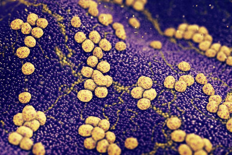 MRSA colonies in yellow on a dark blue background