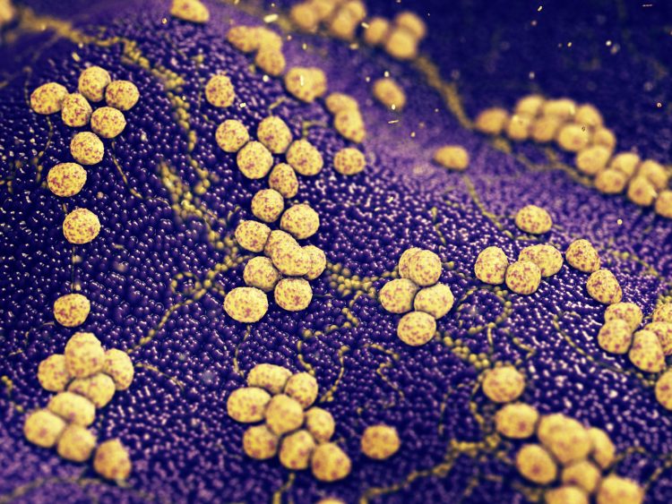 methicillin-resistant Staphylococcus aureus (MRSA) - News, Articles,  Whitepapers - Drug Target Review