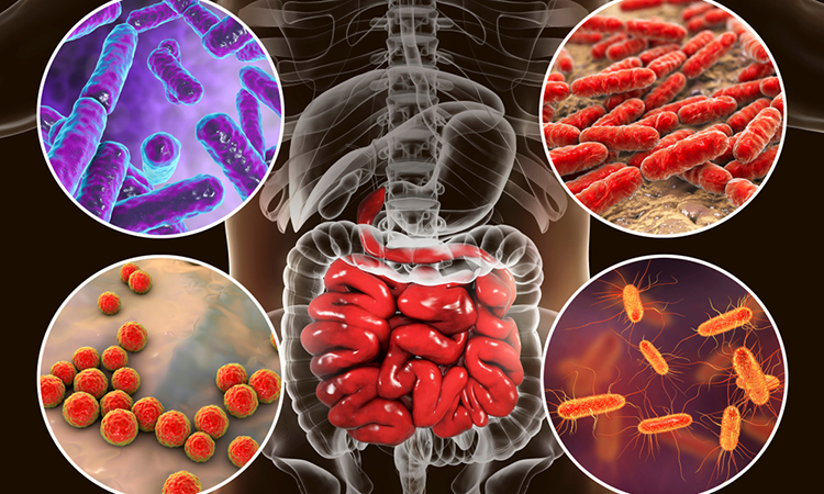 Microbiome