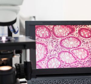 AI use for microscopy