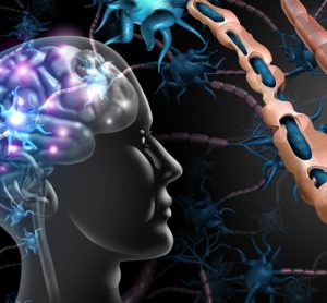 Multiple sclerosis